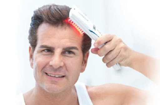điều trị rụng tóc bằng laser,trị rụng tóc bằng laser